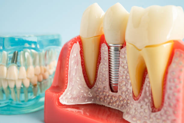 Our Range of Dental Services in West Bay Shore, NY